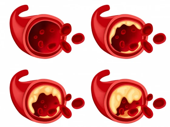 laparoscopic-appendix-surgery-near-me